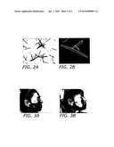 Use of Spongilla Spicules as a Dermabrasion Device or Resurfacing Modality diagram and image