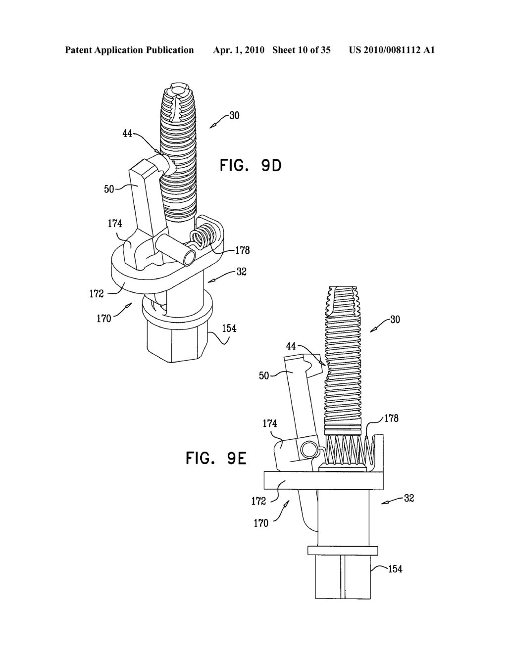 IMPLANTS, TOOLS, AND METHODS FOR SINUS LIFT AND LATERAL RIDGE AUGMENTATION - diagram, schematic, and image 11