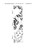 EARLY PROSTATE CANCER ANTIGENS (EPCA), POLYNUCLEOTIDE SEQUENCES ENCODING THEM, AND THEIR USE diagram and image