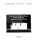 EARLY PROSTATE CANCER ANTIGENS (EPCA), POLYNUCLEOTIDE SEQUENCES ENCODING THEM, AND THEIR USE diagram and image