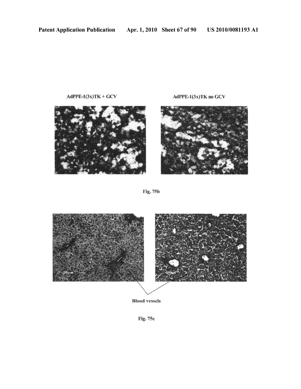 Promoters exhibiting endothelial cell specificity and methods of using same for regulation of angiogenesis - diagram, schematic, and image 68