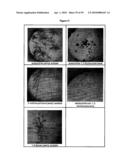 SHORT-ACTING BENZODIAZEPINE SALTS AND THEIR POLYMORPHIC FORMS diagram and image