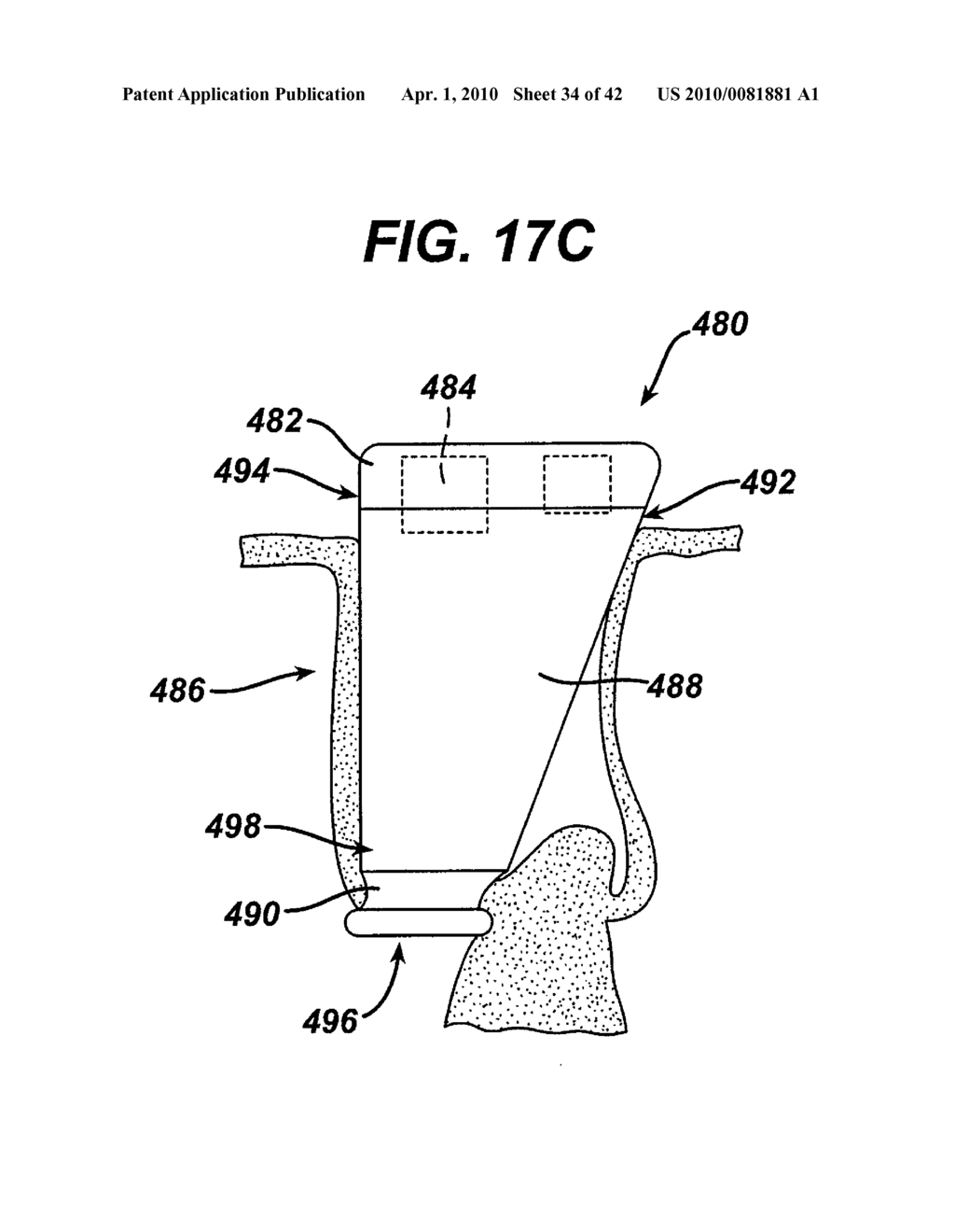 Surgical Access Device with Protective Element - diagram, schematic, and image 35