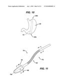 METHODS AND DEVICES FOR PERFORMING GASTROPLASTIES USING A MULTIPLE PORT ACCESS DEVICE diagram and image