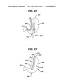 METHODS AND DEVICES FOR PERFORMING GASTROPLASTIES USING A MULTIPLE PORT ACCESS DEVICE diagram and image