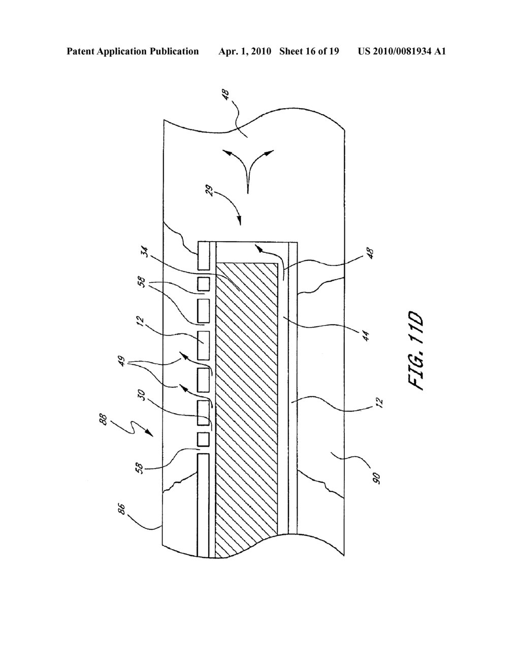 TREATMENT OF VASCULAR OCCLUSIONS USING ULTRASONIC ENERGY AND MICROBUBBLES - diagram, schematic, and image 17