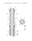 TREATMENT OF VASCULAR OCCLUSIONS USING ULTRASONIC ENERGY AND MICROBUBBLES diagram and image