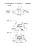 ULTRASONIC DIAGNOSTIC APPARATUS diagram and image