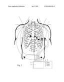 ECG System and Method diagram and image