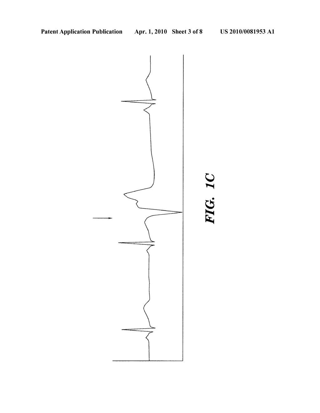 SYSTEM AND METHOD FOR INFERRING DISEASE SIMILARITY BY SHAPE MATCHING OF ECG TIME SERIES - diagram, schematic, and image 04