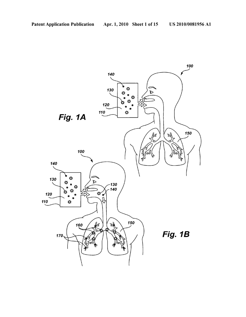 Method, composition, and system to control pH in pulmonary tissue of a subject - diagram, schematic, and image 02