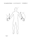 Improved sensors and sensing for monitoring neuromuscular blockade diagram and image