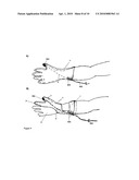 Improved sensors and sensing for monitoring neuromuscular blockade diagram and image