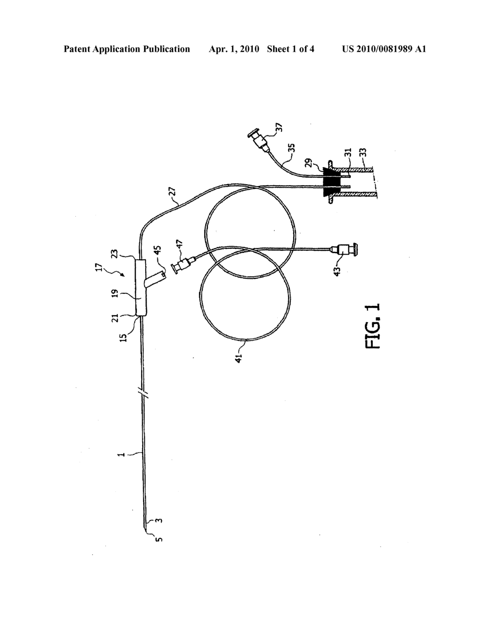 Arrangement for Transferring An Ovum From A Follicle - diagram, schematic, and image 02