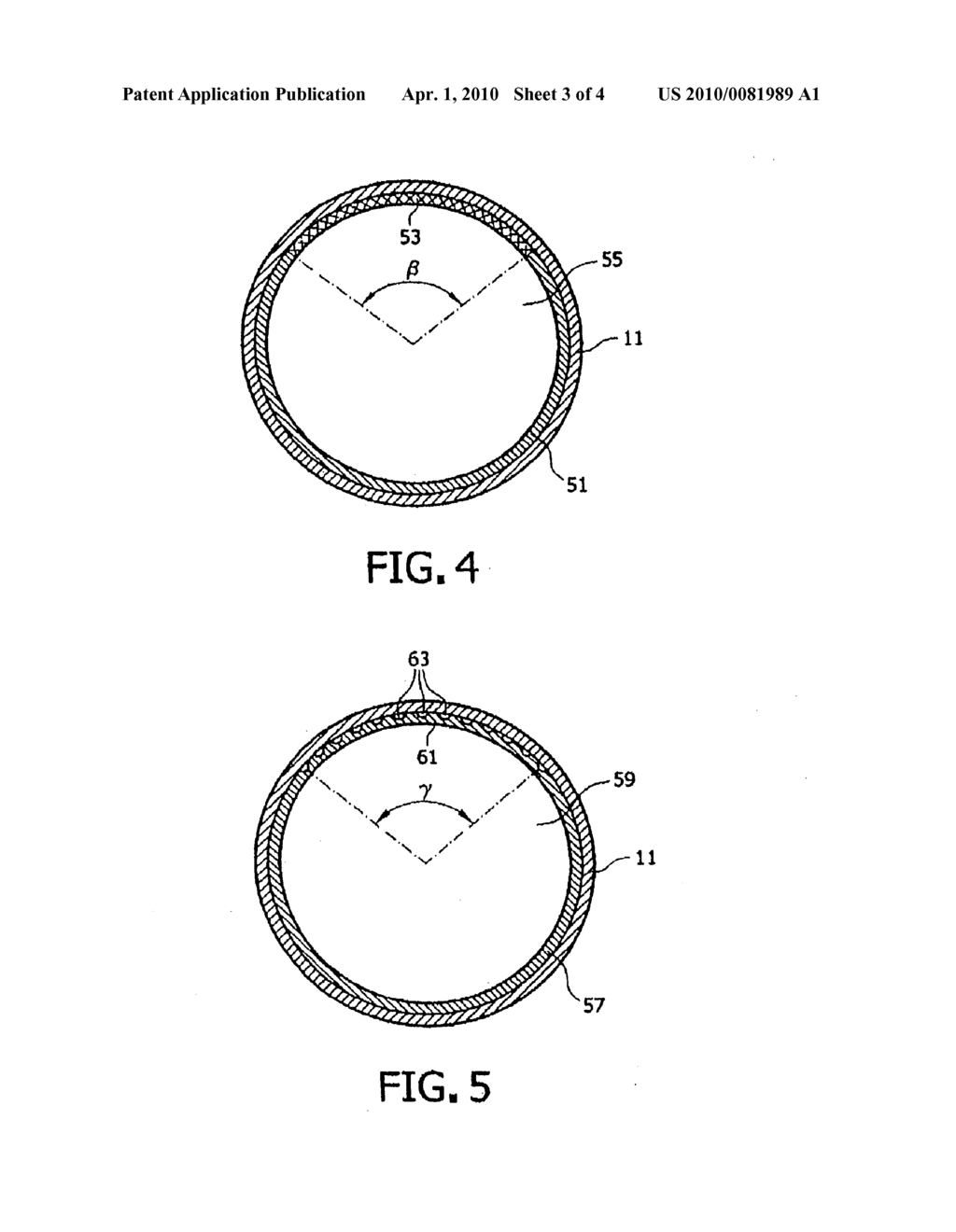 Arrangement for Transferring An Ovum From A Follicle - diagram, schematic, and image 04