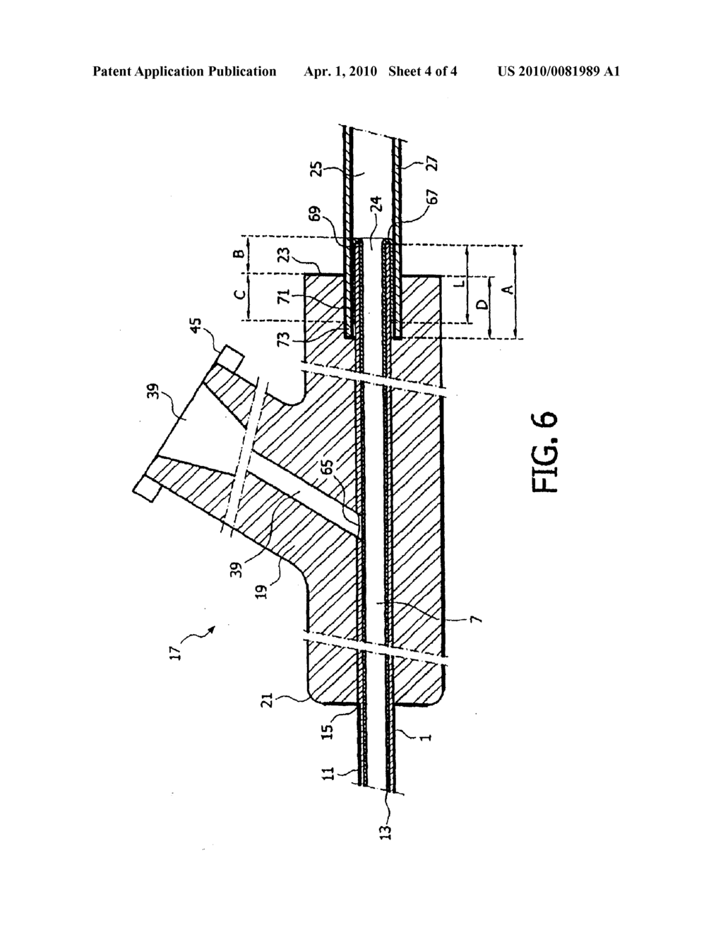 Arrangement for Transferring An Ovum From A Follicle - diagram, schematic, and image 05