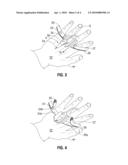 Transparent Catheter Securement System diagram and image