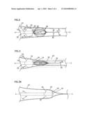 Collection catheter and kit diagram and image