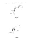 TREATMENT TIP INCISION TEMPLATE diagram and image