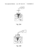 TREATMENT TIP INCISION TEMPLATE diagram and image