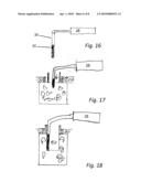 TREATMENT TIP INCISION TEMPLATE diagram and image