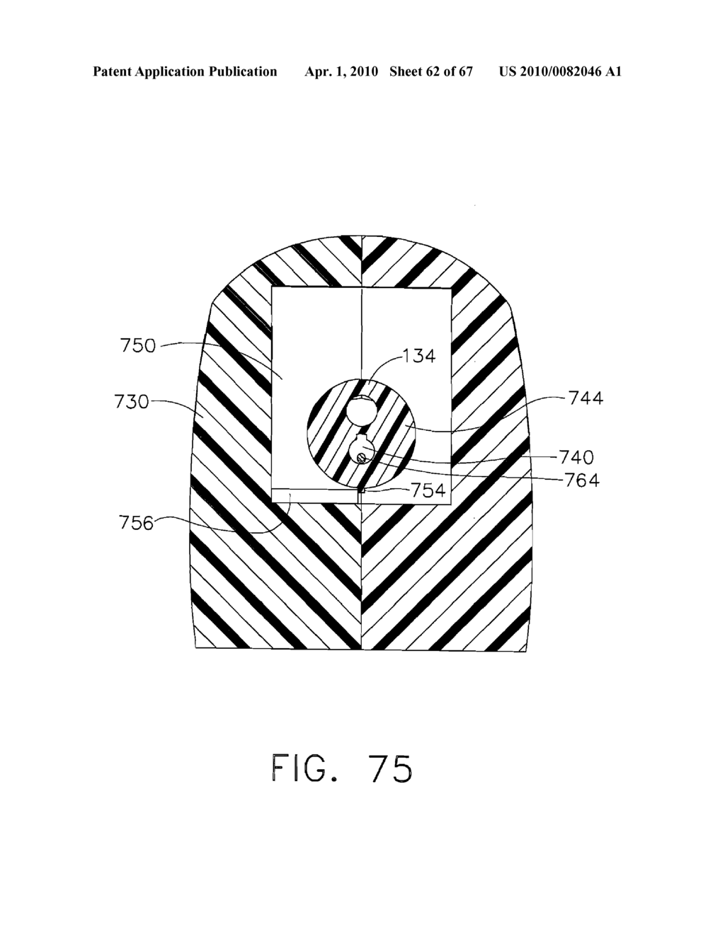  Device For Deploying A Fastener For Use in a Gastric Volume Reduction Procedure - diagram, schematic, and image 63