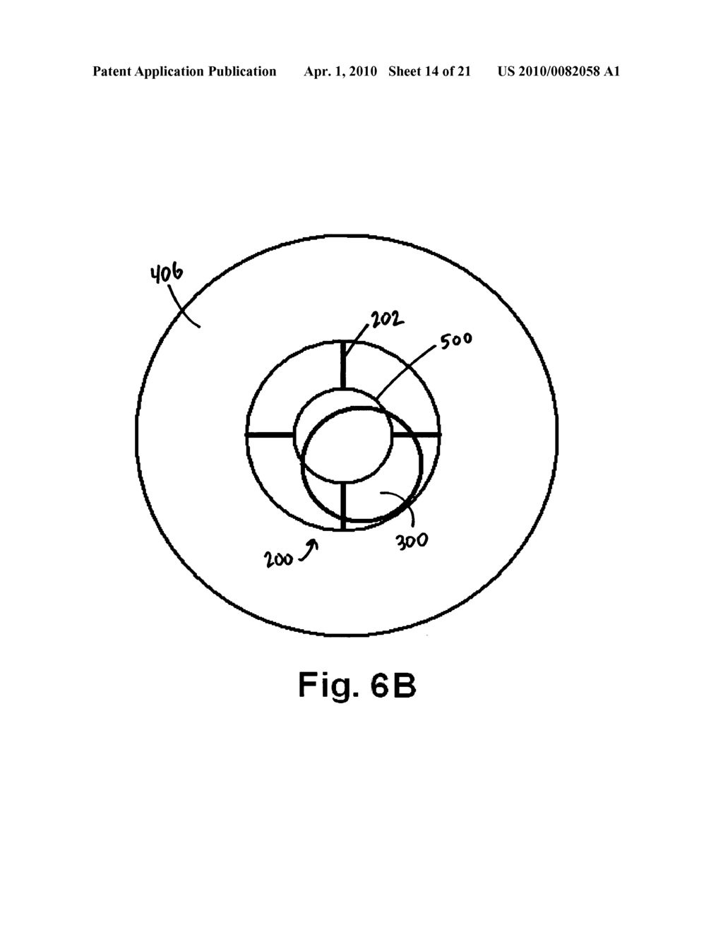 DEVICES, SYSTEMS AND METHODS FOR CONTROLLING LOCAL BLOOD PRESSURE - diagram, schematic, and image 15