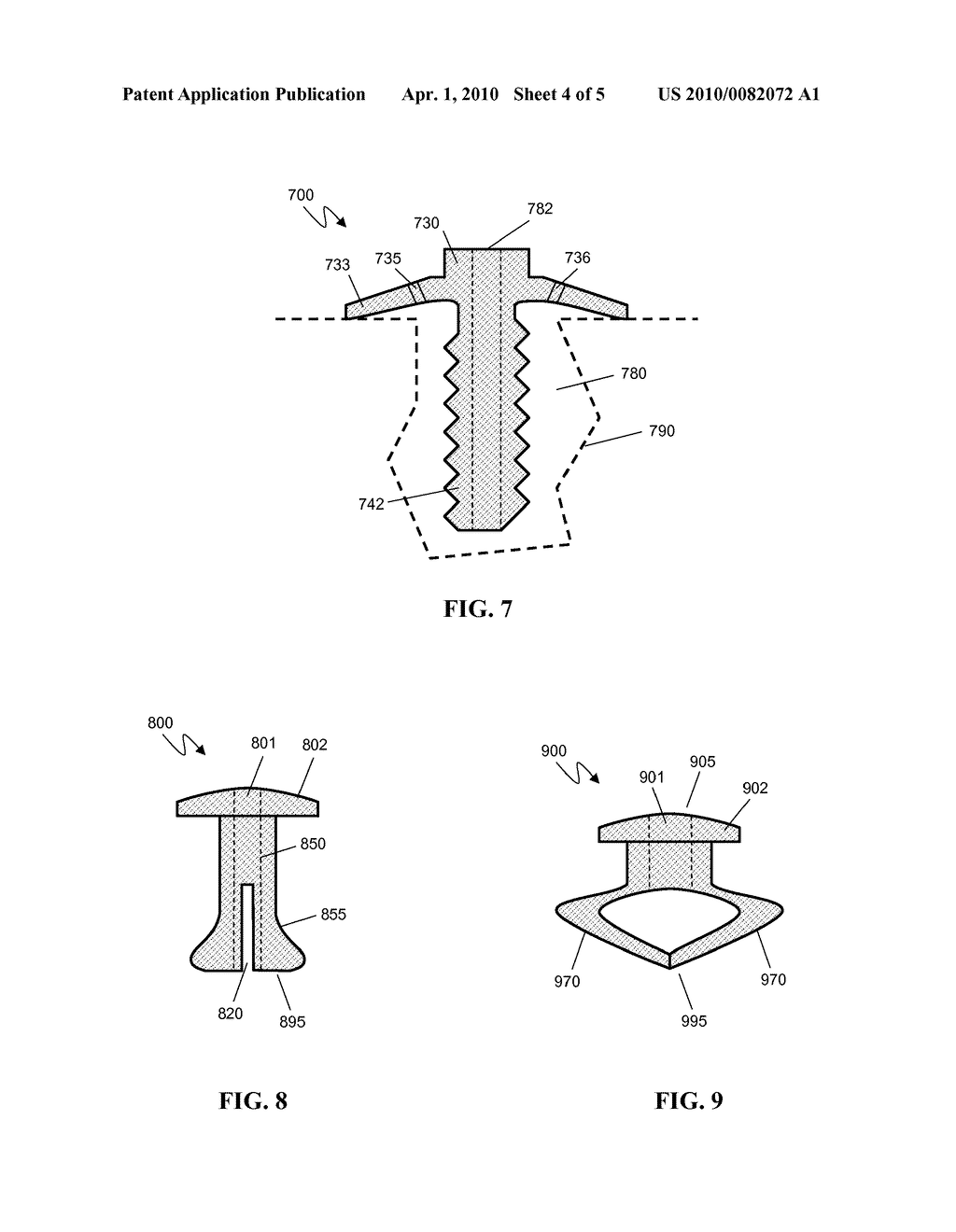 BONE ANCHORS FOR ORTHOPEDIC APPLICATIONS - diagram, schematic, and image 05