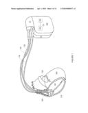 Method and Apparatus to Optimize Pacing Heart Rate diagram and image