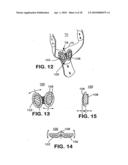 ELECTRODES FOR ORTHOTIC DEVICE diagram and image