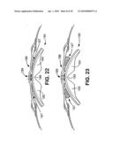 ELECTRODES FOR ORTHOTIC DEVICE diagram and image