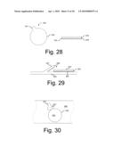 ELECTRODES FOR ORTHOTIC DEVICE diagram and image