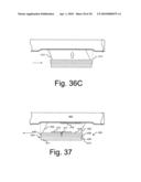 ELECTRODES FOR ORTHOTIC DEVICE diagram and image