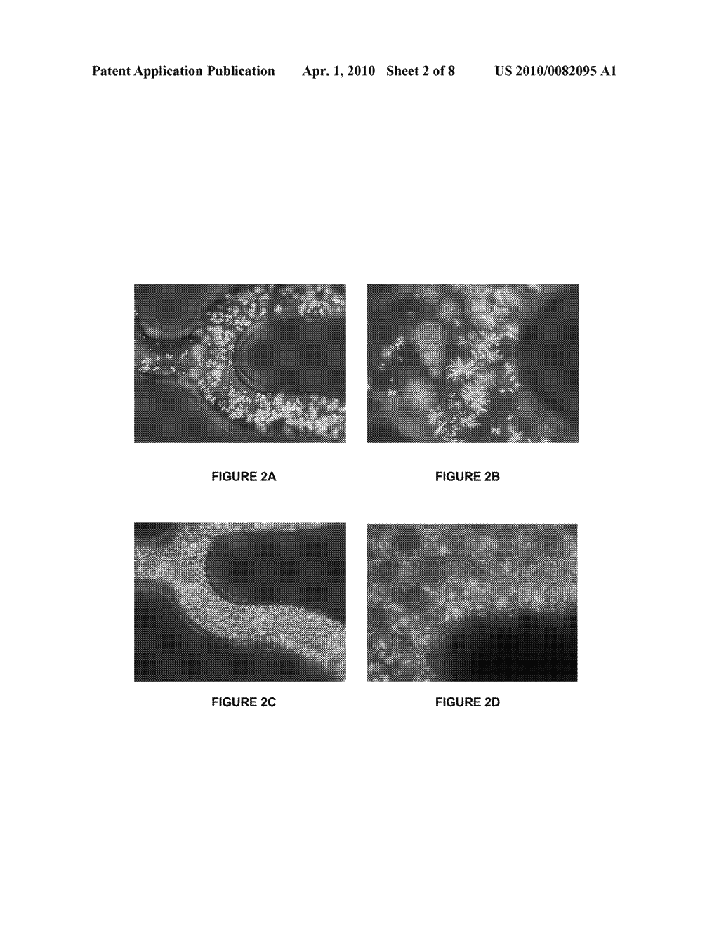 Coatings Including Dexamethasone Derivatives And Analogs And Olimus Drugs - diagram, schematic, and image 03