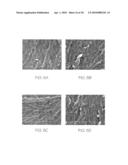 HIGHLY CRYSTALLINE POLYETHYLENE diagram and image