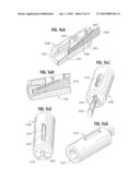 Materials and Methods for Improved Bone Tendon Bone Transplantation diagram and image