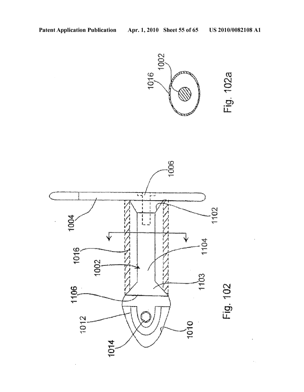 SPINE DISTRACTION IMPLANT AND METHOD - diagram, schematic, and image 56