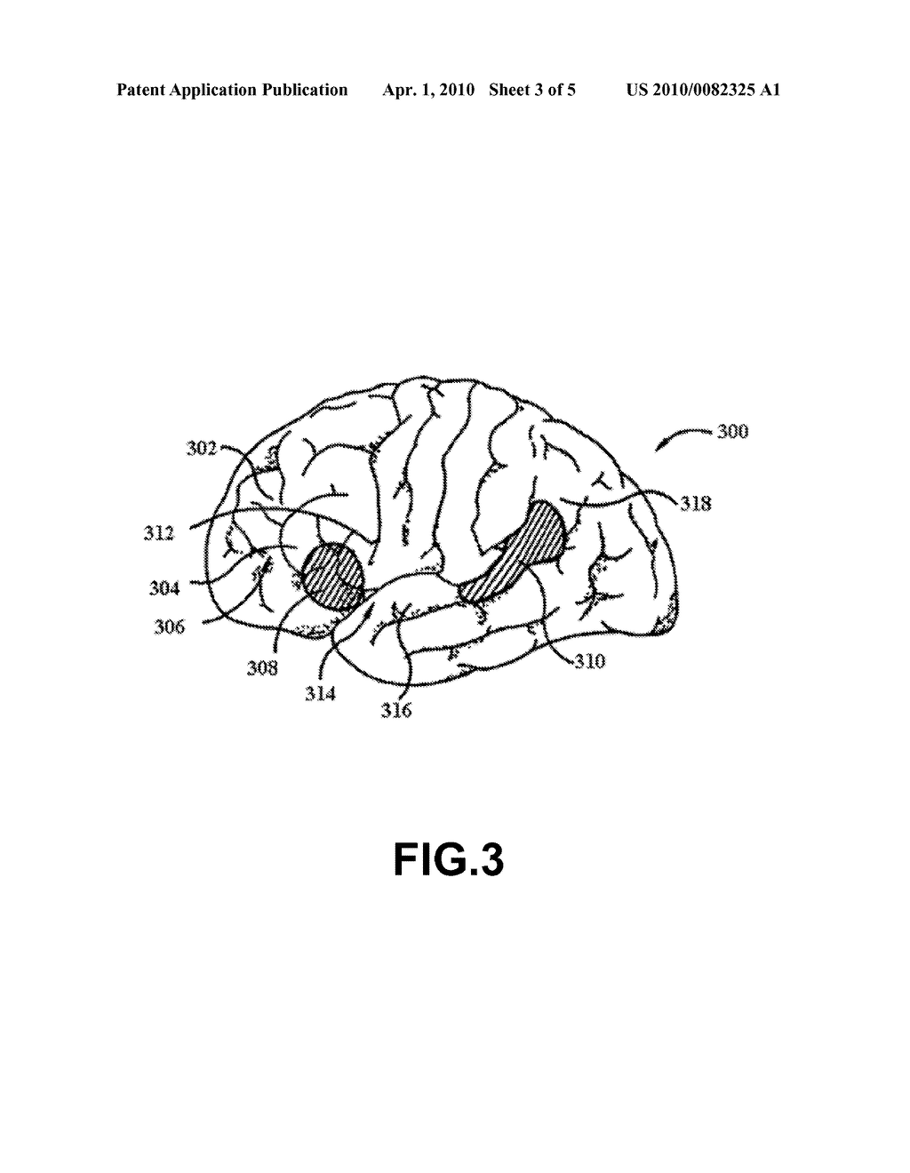 Automated phonetic language translation system using Human Brain Interface - diagram, schematic, and image 04