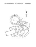 APPARATUS AND METHOD FOR MOUNTING A CLOSE-COUPLED CATALYST diagram and image