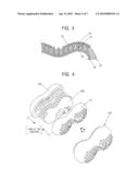 Durable Bone With Soft Core diagram and image