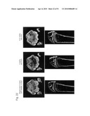 OSTEOPENIA ANIMAL MODEL diagram and image