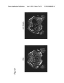 OSTEOPENIA ANIMAL MODEL diagram and image