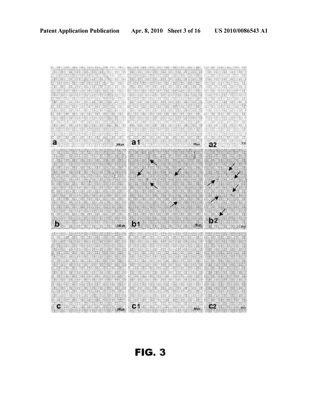 COMPOSITIONS AND METHODS FOR TREATING CONDITIONS ASSOCIATED WITH CERAMIDE BIOSYNTHESIS - diagram, schematic, and image 04