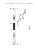 Prevention and Treatment of Synucleinopathic and Amyloidogenic Disease diagram and image