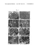 TRAVERSAL OF NUCLEIC ACID MOLECULES THROUGH A FLUID SPACE AND EXPRESSION IN REPAIR CELLS diagram and image