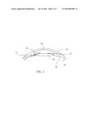 METHODS FOR USING TGF-B RECEPTOR INHIBITORS OR ACTIVIN-LIKE KINASE (ALK) 5 INHIBITORS A-83-01 AND SB-431542 TO TREAT EYE DISEASE AND WOUND HEALING CONDITIONS diagram and image