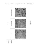 METHODS FOR USING TGF-B RECEPTOR INHIBITORS OR ACTIVIN-LIKE KINASE (ALK) 5 INHIBITORS A-83-01 AND SB-431542 TO TREAT EYE DISEASE AND WOUND HEALING CONDITIONS diagram and image