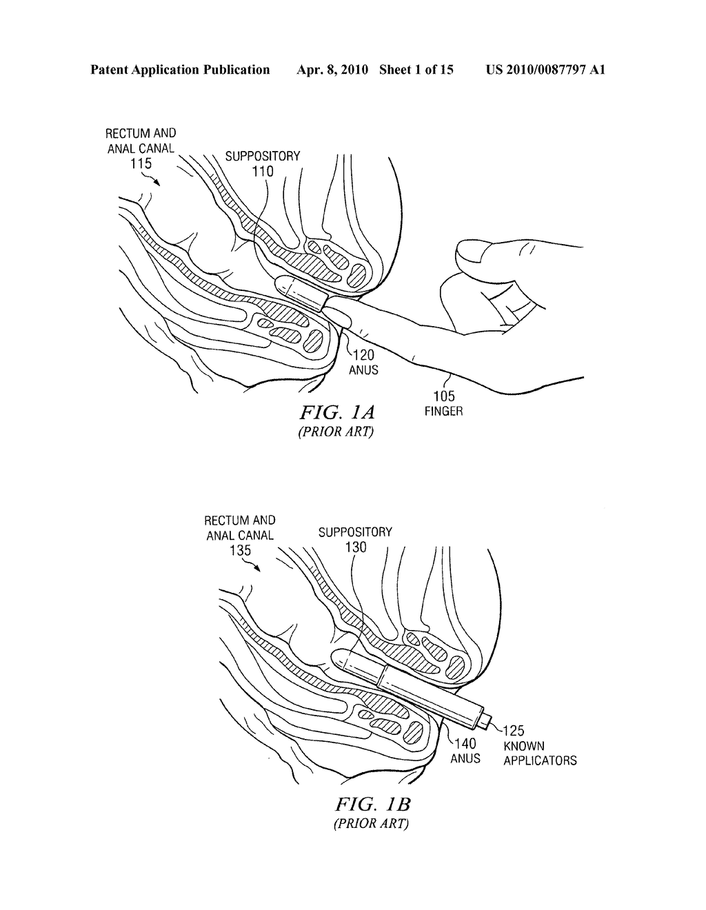 Method and apparatus for inserting a rectal suppository - diagram, schematic, and image 02