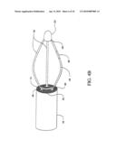 Sphincter treatment apparatus diagram and image