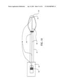 Sphincter treatment apparatus diagram and image